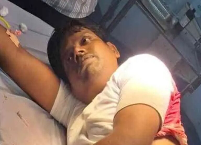 रातू ी२ं हाईकोर्ट के अधिवक्ता को अपराधियों ने मारी गोली, गंभीर