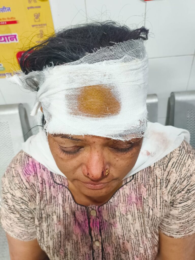 रामगढ़ के पायल होटल में जमकर मारपीट, होटल की मालकिन ममता शरण गंभीर रूप से घायल